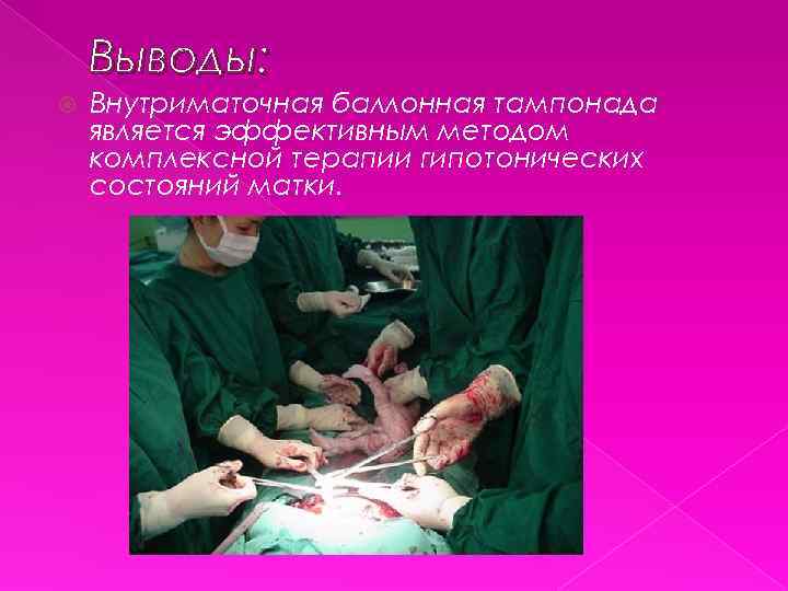 Выводы: Внутриматочная баллонная тампонада является эффективным методом комплексной терапии гипотонических состояний матки. 