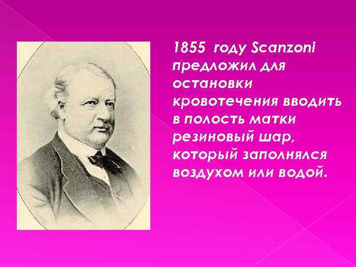 1855 году Scanzoni предложил для остановки кровотечения вводить в полость матки резиновый шар, который