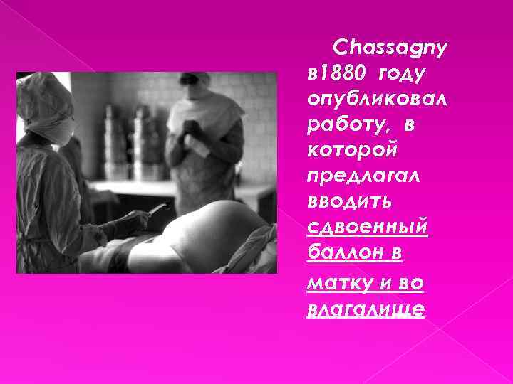 Chassagny в 1880 году опубликовал работу, в которой предлагал вводить сдвоенный баллон в матку
