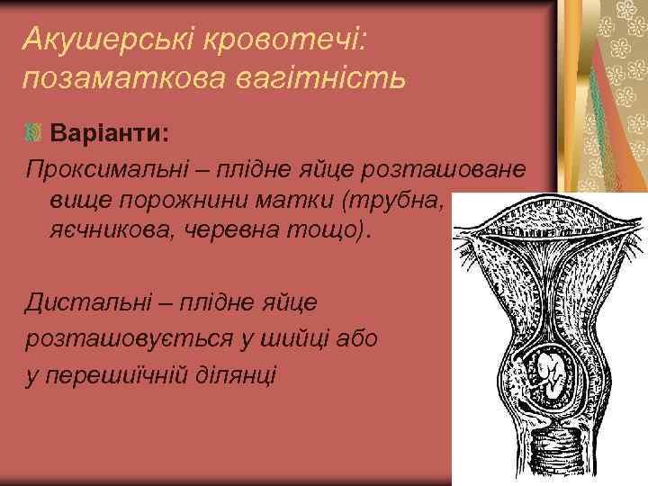 Акушерські кровотечі: позаматкова вагітність Варіанти: Проксимальні – плідне яйце розташоване вище порожнини матки (трубна,