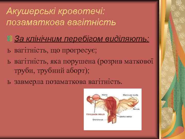 Акушерські кровотечі: позаматкова вагітність За клінічним перебігом виділяють: ь вагітність, що прогресує; ь вагітність,