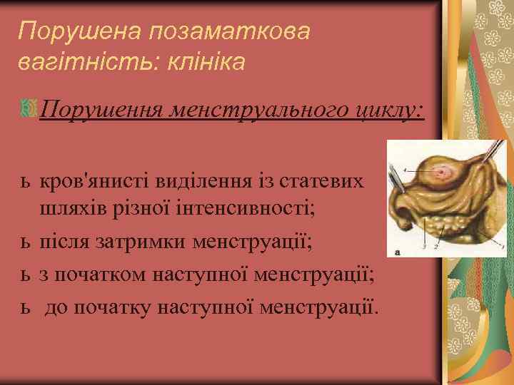 Порушена позаматкова вагітність: клініка Порушення менструального циклу: ь кров'янисті виділення із статевих шляхів різної