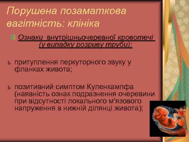 Порушена позаматкова вагітність: клініка Ознаки внутрішньочеревної кровотечі (у випадку розриву труби): ь притуплення перкуторного