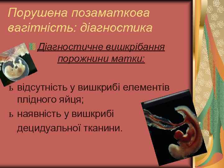 Порушена позаматкова вагітність: діагностика Діагностичне вишкрібання порожнини матки: ь відсутність у вишкрибі елементів плідного