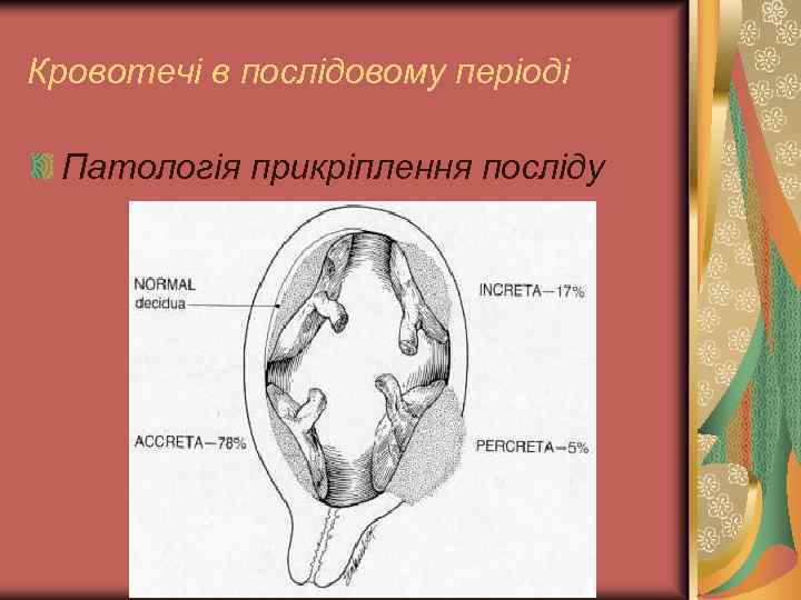 Кровотечі в послідовому періоді Патологія прикріплення посліду 