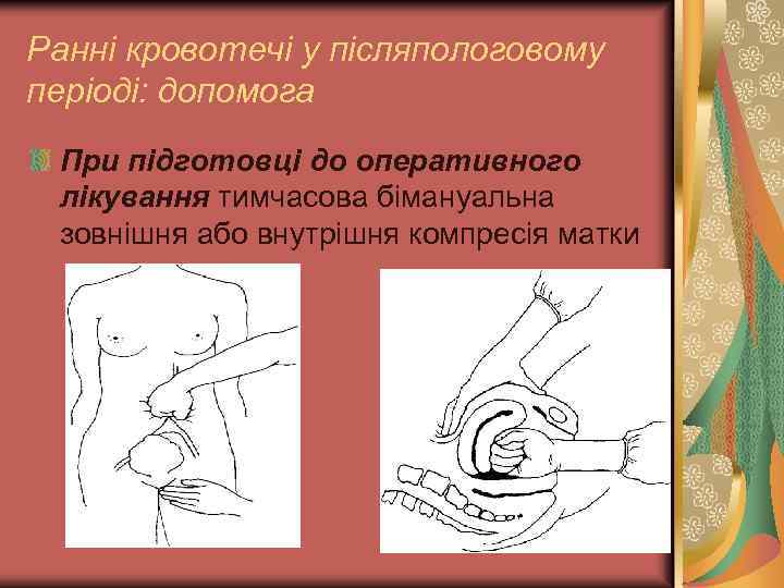Ранні кровотечі у післяпологовому періоді: допомога При підготовці до оперативного лікування тимчасова бімануальна зовнішня