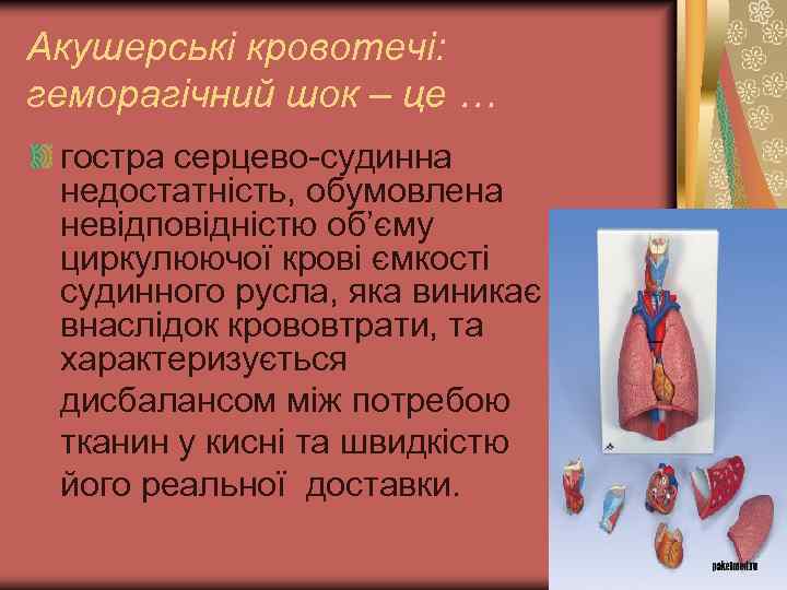 Акушерські кровотечі: геморагічний шок – це … гостра серцево-судинна недостатність, обумовлена невідповідністю об’єму циркулюючої