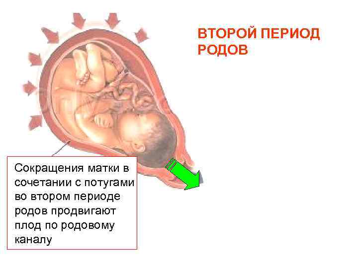 ВТОРОЙ ПЕРИОД РОДОВ Сокращения матки в сочетании с потугами во втором периоде родов продвигают