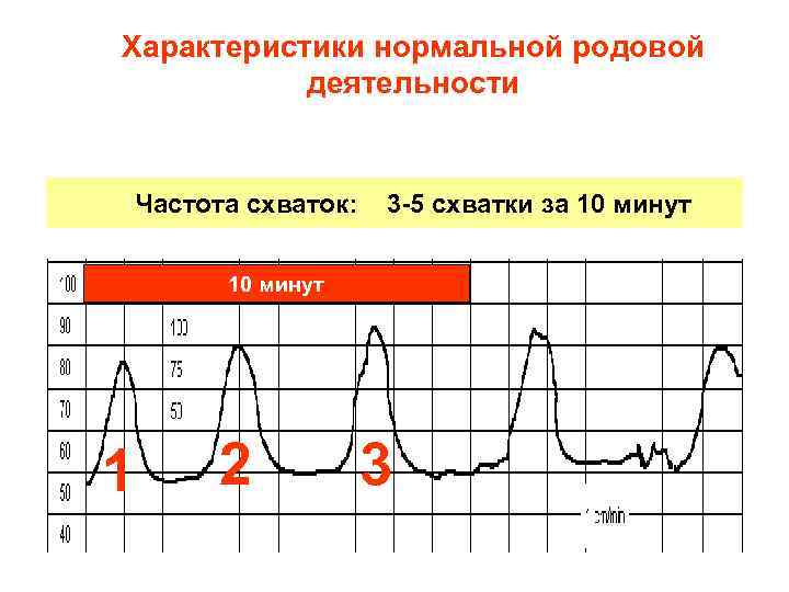 Характеристики нормальной родовой деятельности Частота схваток: 3 -5 схватки за 10 минут 1 2