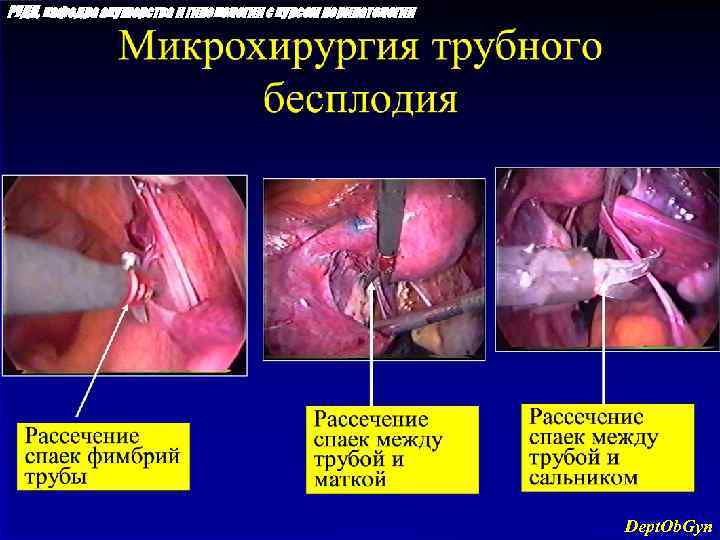 РУДН, кафедра акушерства и гинекологии с курсом перинатологии Dept. Ob. Gyn 