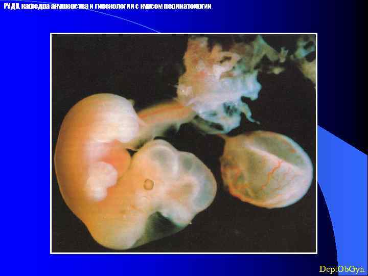 РУДН, кафедра акушерства и гинекологии с курсом перинатологии Dept. Ob. Gyn 