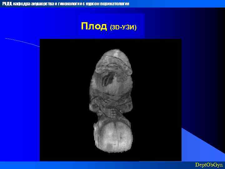 РУДН, кафедра акушерства и гинекологии с курсом перинатологии Плод (3 D-УЗИ) Dept. Ob. Gyn