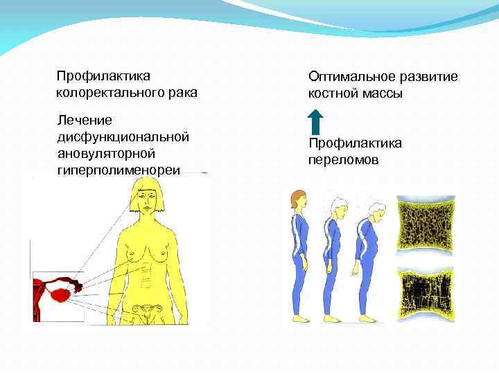 Профилактика колоректального рака Оптимальное развитие костной массы Лечение дисфункциональной ановуляторной гиперполименореи Профилактика переломов 