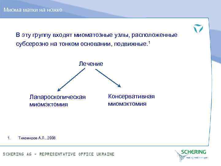 Миома матки на ножке В эту группу входят миоматозные узлы, расположенные субсерозно на тонком