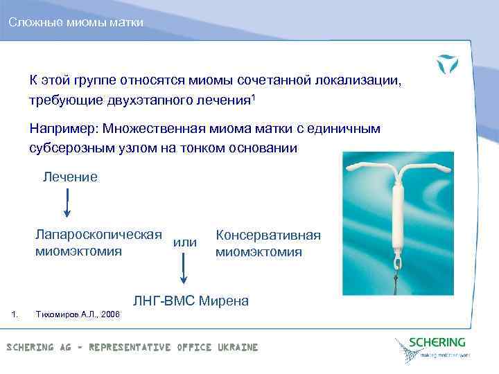 Сложные миомы матки К этой группе относятся миомы сочетанной локализации, требующие двухэтапного лечения 1