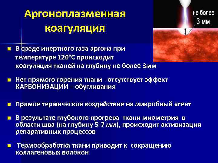 Аргоноплазменная коагуляция n В среде инертного газа аргона при температуре 120°С происходит коагуляция тканей