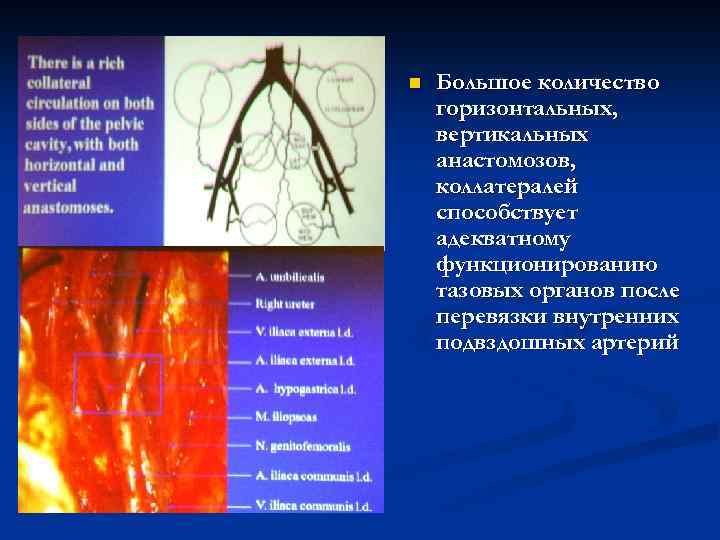n Большое количество горизонтальных, вертикальных анастомозов, коллатералей способствует адекватному функционированию тазовых органов после перевязки