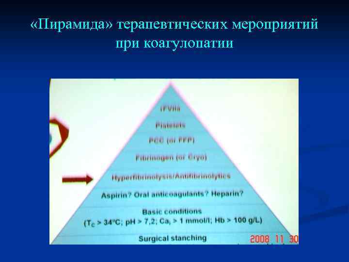  «Пирамида» терапевтических мероприятий при коагулопатии 
