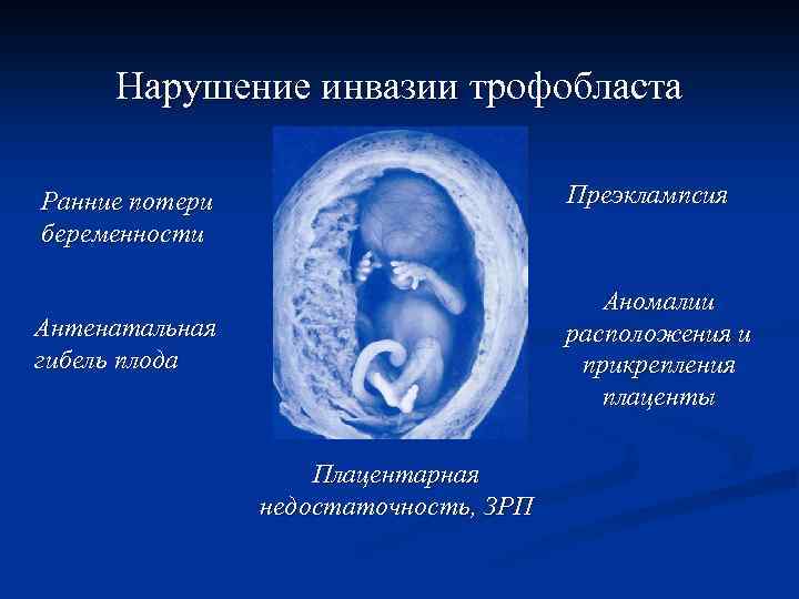 Нарушение инвазии трофобласта Преэклампсия Ранние потери беременности Аномалии расположения и прикрепления плаценты Антенатальная гибель