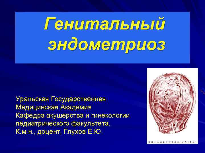 Генитальный эндометриоз Уральская Государственная Медицинская Академия Кафедра акушерства и гинекологии педиатрического факультета. К. м.