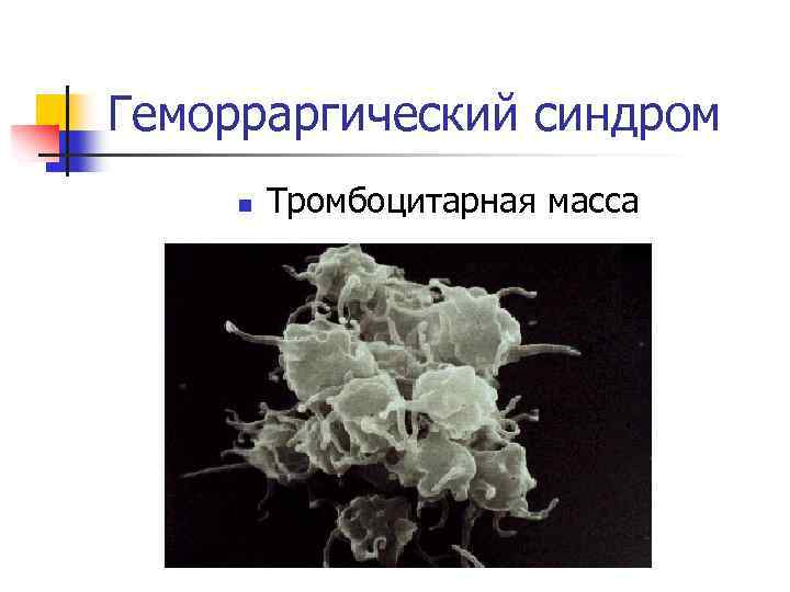 Геморраргический синдром n Тромбоцитарная масса 