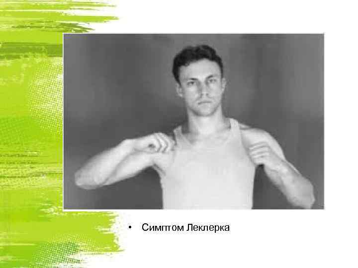  • Симптом Леклерка 