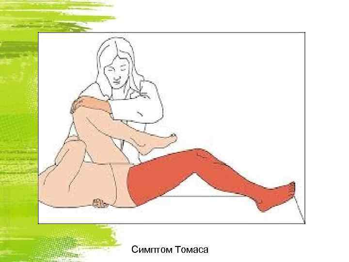 Симптом Томаса 