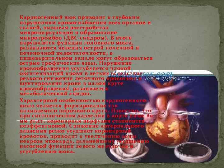 Кардиогенный шок приводит к глубоким нарушениям кровоснабжения всех органов и тканей, вызывая расстройства микроциркуляции