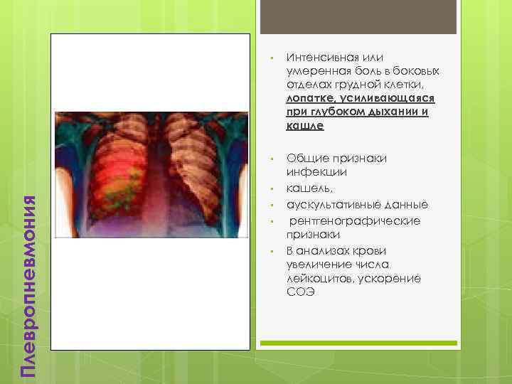  • Интенсивная или умеренная боль в боковых отделах грудной клетки, лопатке, усиливающаяся при