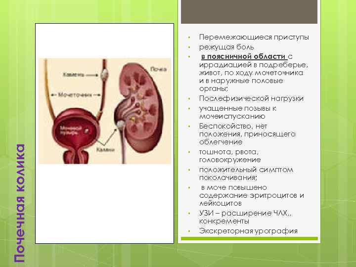  • • • Почечная колика • • • Перемежающиеся приступы режущая боль в