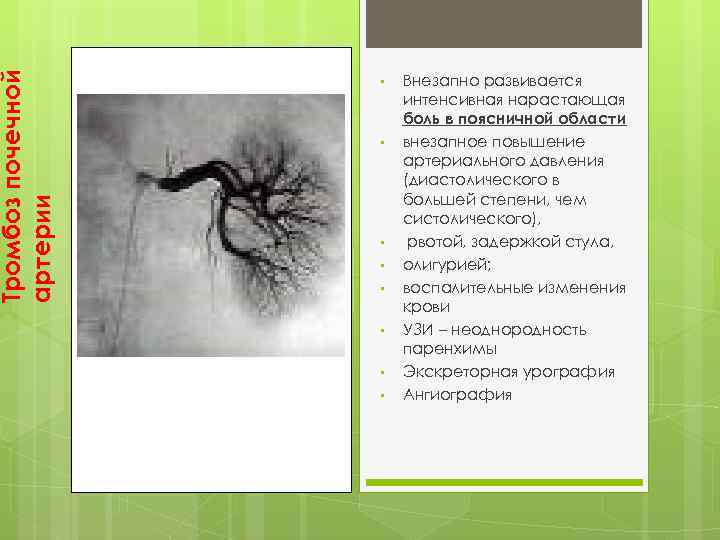 Тромбоз почечной артерии • • Внезапно развивается интенсивная нарастающая боль в поясничной области внезапное