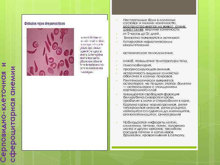 Серповидно-клеточная и сфероцитарная анемии • • Нестерпимые боли в коленных суставах и нижних конечностях,