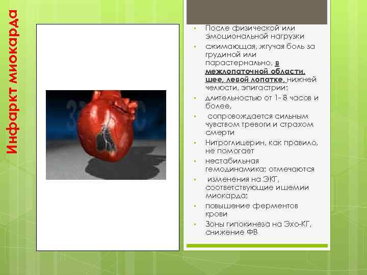 Инфаркт миокарда • • • После физической или эмоциональной нагрузки сжимающая, жгучая боль за