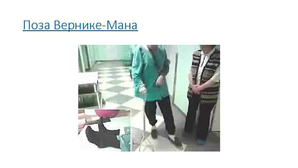 Поза Вернике-Мана 