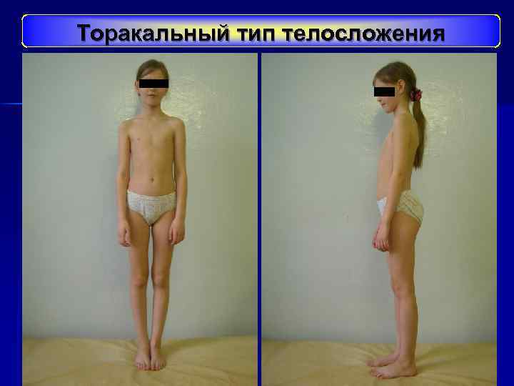 Торакальный тип телосложения 