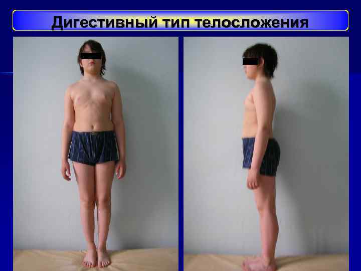 Дигестивный тип телосложения 