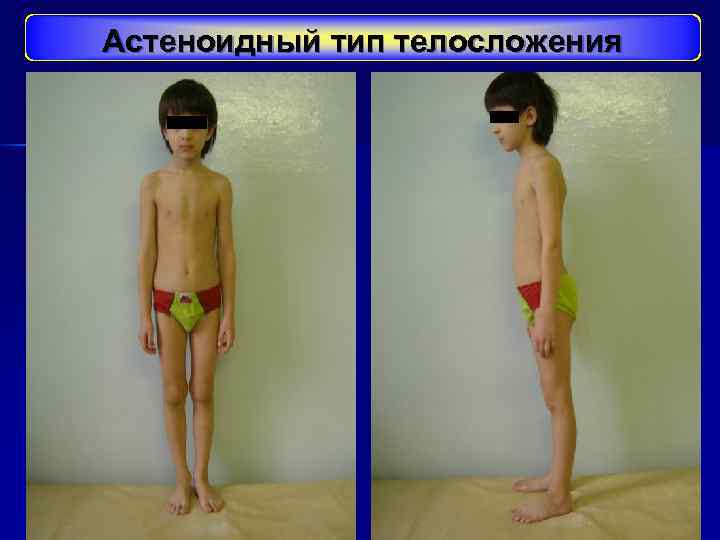 Астеноидный тип телосложения 