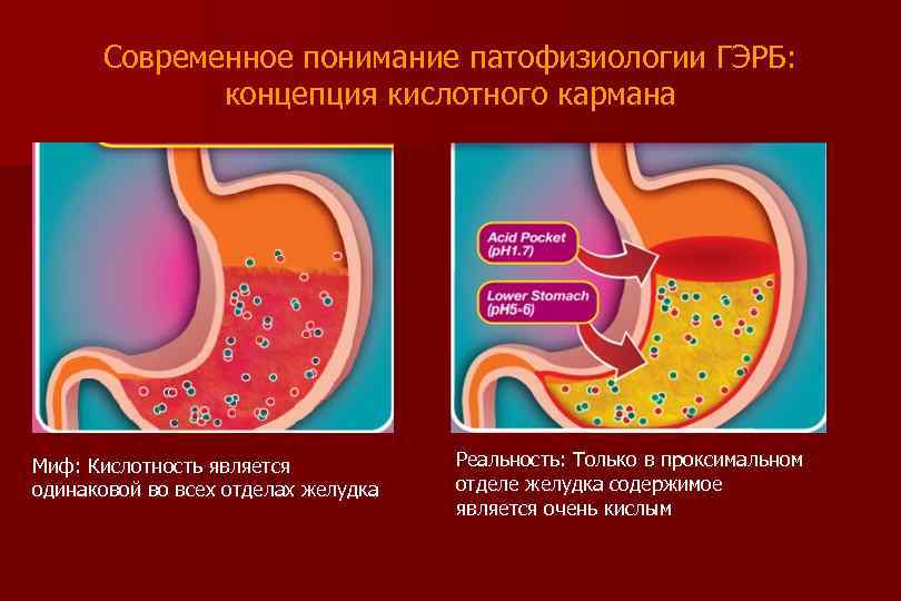 Современное понимание патофизиологии ГЭРБ: концепция кислотного кармана Миф: Кислотность является одинаковой во всех отделах