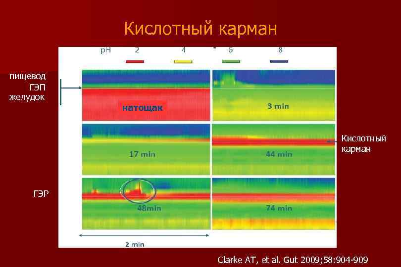 Кислотный карман пищевод ГЭП желудок натощак Кислотный карман ГЭР Clarke AT, et al. Gut