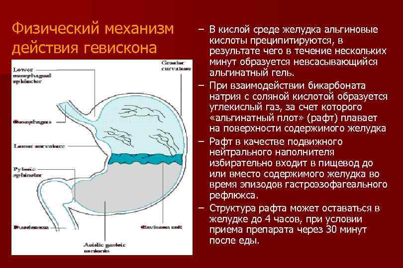 Физический механизм действия гевискона – В кислой среде желудка альгиновые кислоты преципитируются, в результате