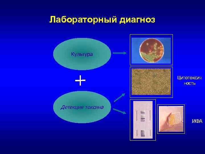 Лабораторный диагноз Культура Цитотоксич ность Детекция токсина ИФА 
