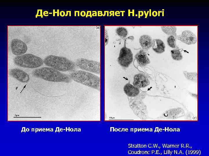 Де-Нол подавляет Н. pylori До приема Де-Нола После приема Де-Нола Stratton C. W. ,