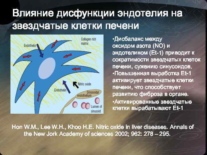 Влияние дисфункции эндотелия на звездчатые клетки печени • Дисбаланс между оксидом азота (NO) и