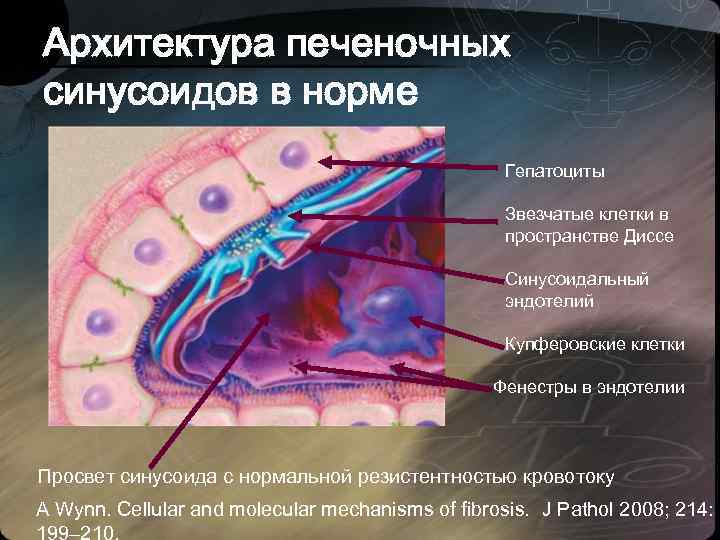 Архитектура печеночных синусоидов в норме Гепатоциты Звезчатые клетки в пространстве Диссе Синусоидальный эндотелий Купферовские