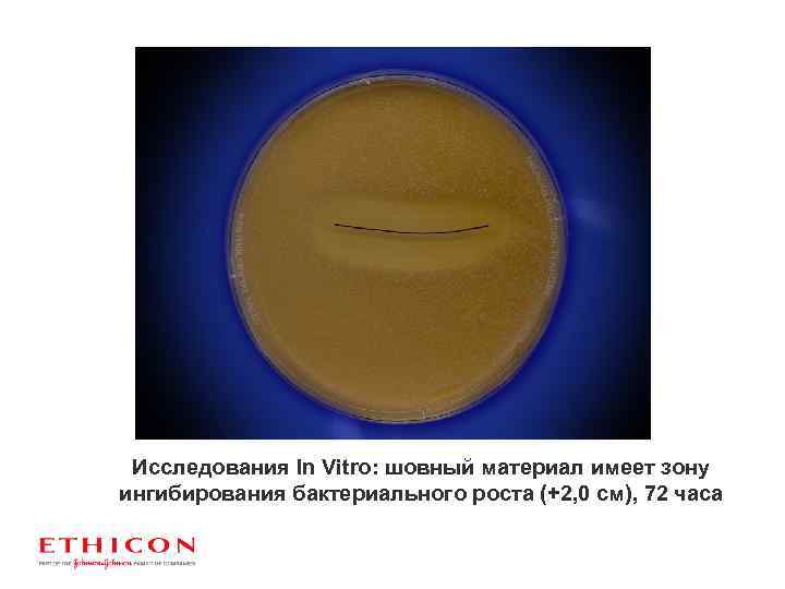 Исследования In Vitro: шовный материал имеет зону ингибирования бактериального роста (+2, 0 см), 72