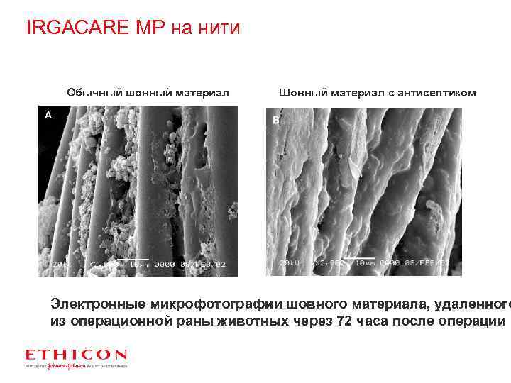 IRGACARE МР на нити Обычный шовный материал Шовный материал с антисептиком Электронные микрофотографии шовного