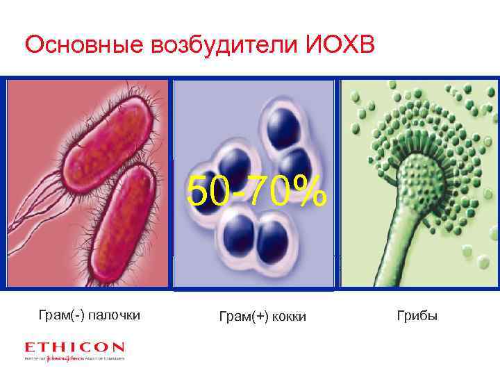 Основные возбудители ИОХВ 25% частота (%) 20% 15% 50 -70% 10% 5% 0% Staphylococcus