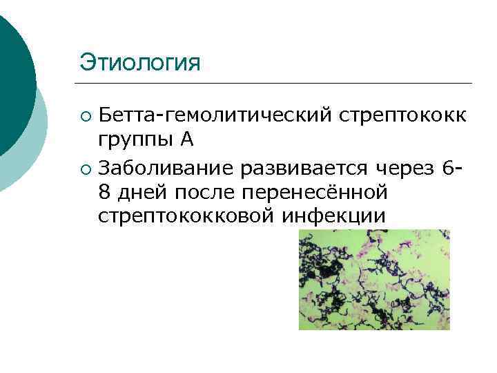 Этиология Бетта-гемолитический стрептококк группы А ¡ Заболивание развивается через 68 дней после перенесённой стрептококковой