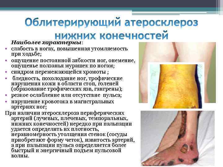 Наиболее характерны: • слабость в ногах, повышенная утомляемость при ходьбе; • ощущение постоянной зябкости