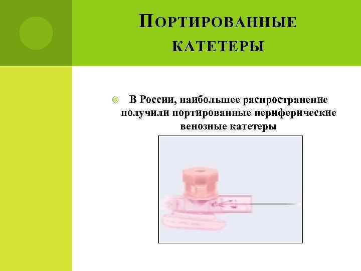 П ОРТИРОВАННЫЕ КАТЕТЕРЫ В России, наибольшее распространение получили портированные периферические венозные катетеры 